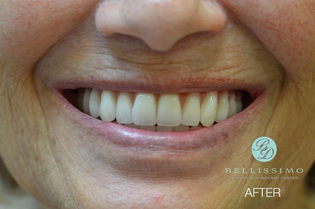Smile Gallery | Bellissimo Dentistry & Implant Center | Chandler, AZ